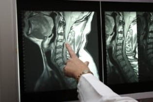 Röntgenfoto van de nek