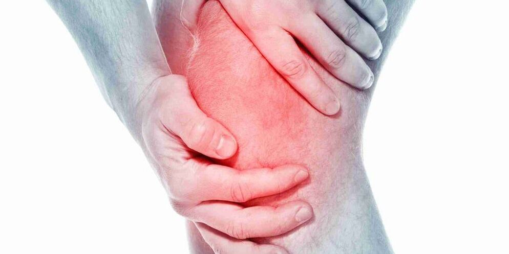 Pijn in een gebogen of rechte knie is een symptoom van artrose van het kniegewricht