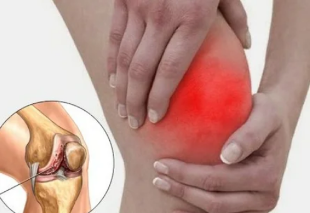 Wat gebeurt er als artritis