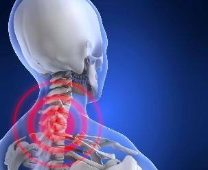 De locatie van de pijn in de cervicale osteochondrosis